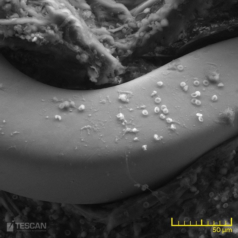 A piece of cardiac tissue with an implanted cardiovascular stent - LVSTD detector