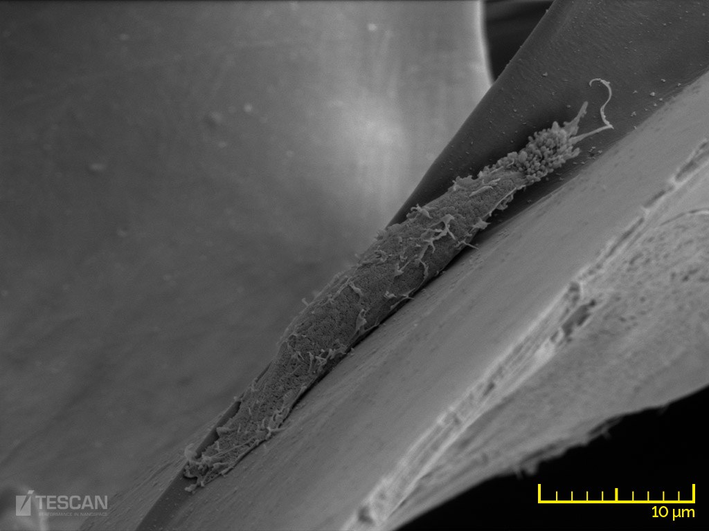 A fibroblast growing on a collagen scaffold