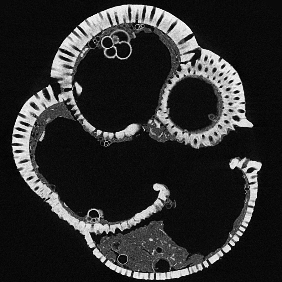 Foraminifera microfossil – 2D cross section