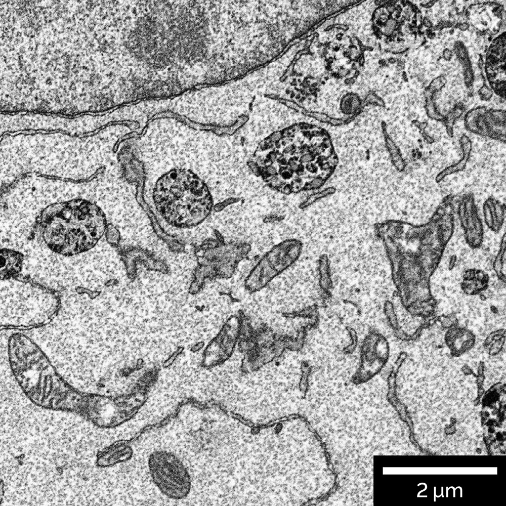Resin_embedded mammalian cells. Additionally inverted image was acquired using In-Beam BSE detector at accelerating voltage 2.5 keV