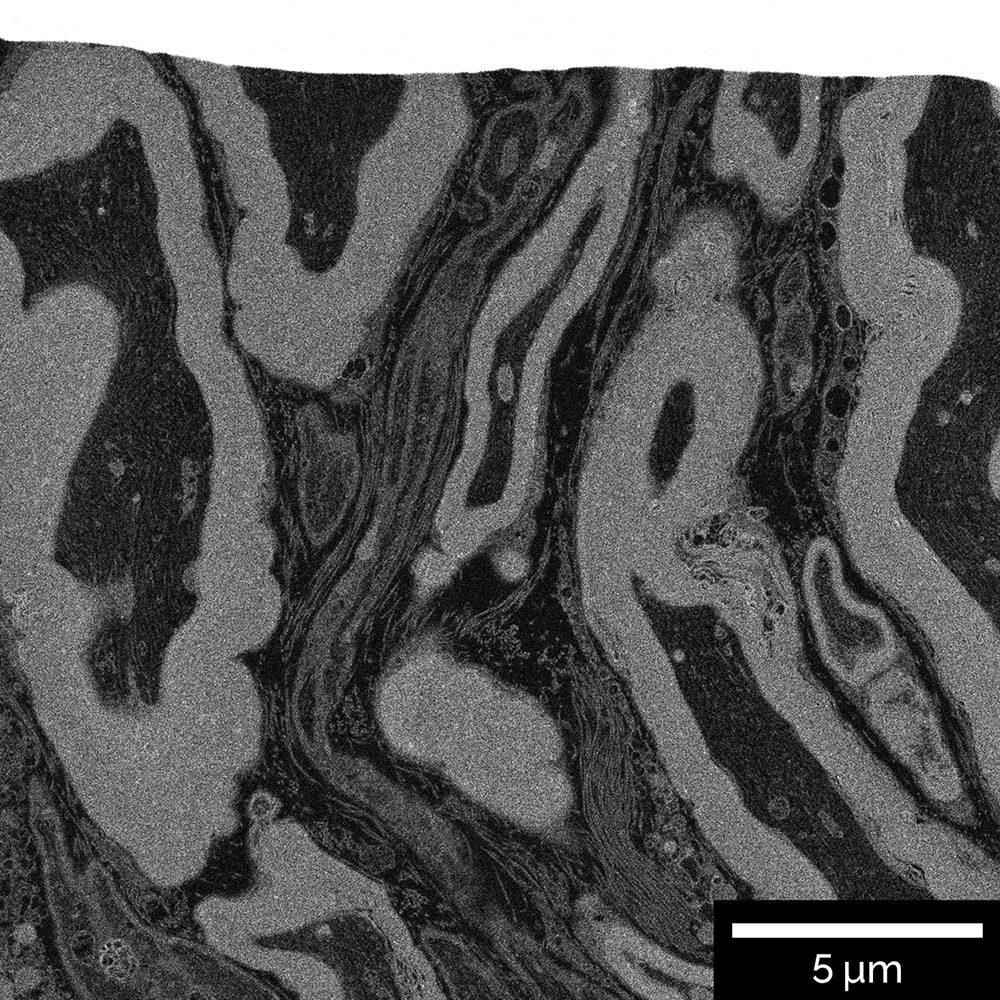 Resin_embedded brain tissue. Cross-section was prepared with Ga FIB and visualized using In-Beam BSE detector